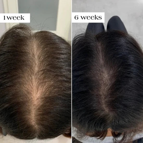 🔥LAST DAY 60% OFF - 🌿Vivitoky® Organic Rosemary Hair Growth Shampoo