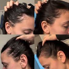 🔥LAST DAY 60% OFF - 🌿Vivitoky® Organic Rosemary Hair Growth Shampoo