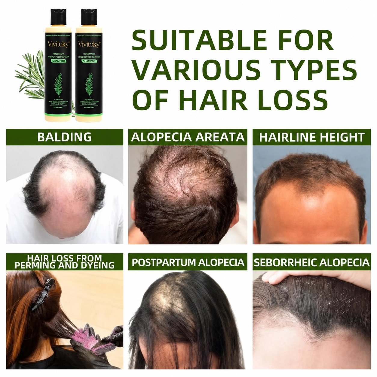 🔥LAST DAY 60% OFF - 🌿Vivitoky® Organic Rosemary Hair Growth Shampoo