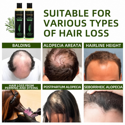 🔥LAST DAY 60% OFF - 🌿Vivitoky® Organic Rosemary Hair Growth Shampoo