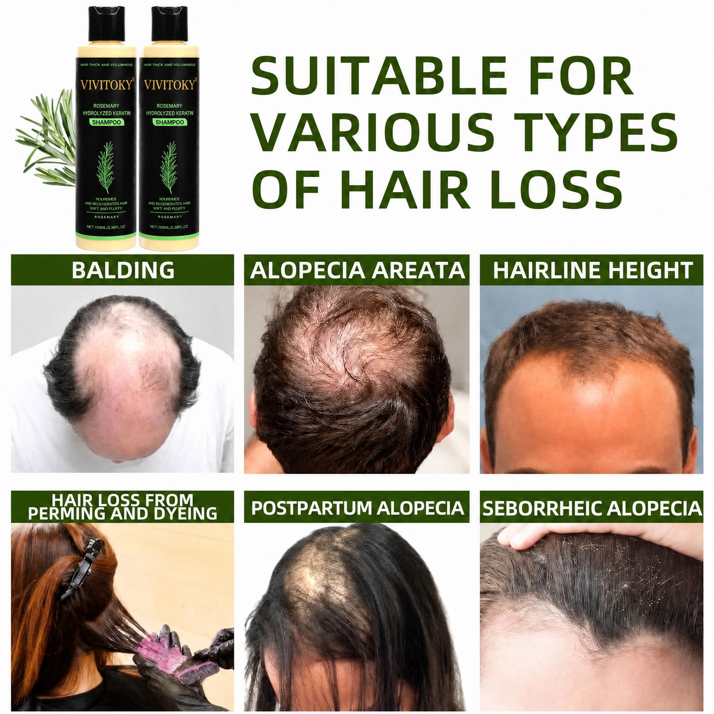 🔥LAST DAY 60% OFF - 🌿Vivitoky® Organic Rosemary Hair Growth Shampoo