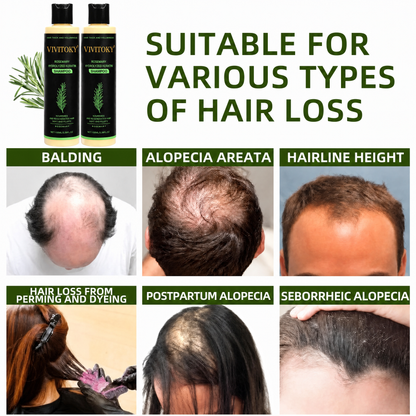 🔥LAST DAY 60% OFF - 🌿Vivitoky® Organic Rosemary Hair Growth Shampoo